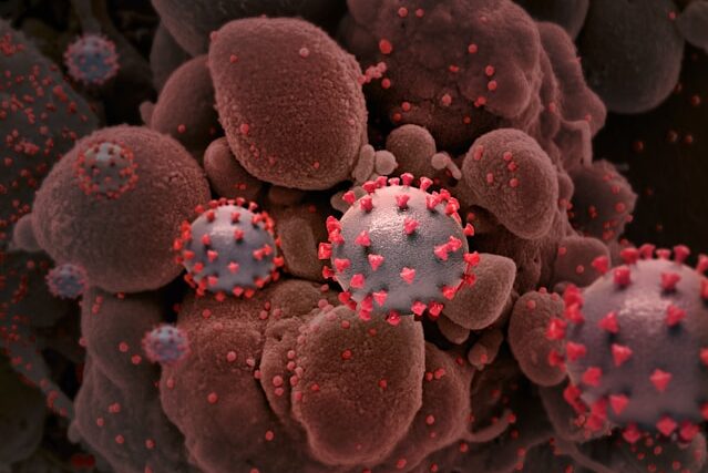 National Institute Of Allergy And Infectious Diseases U W1X9vhX8 Unsplash E1783588814619
